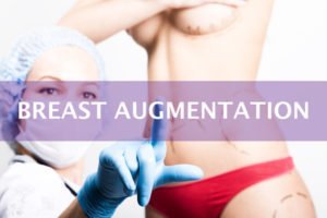 Tampa Breast Augmentation model with a plastic surgeon