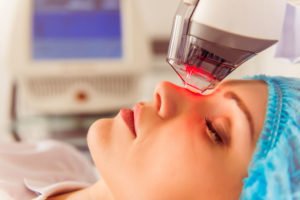 Tampa Laser Skin Resurfacing model undergoing facial rejuvenation treatment